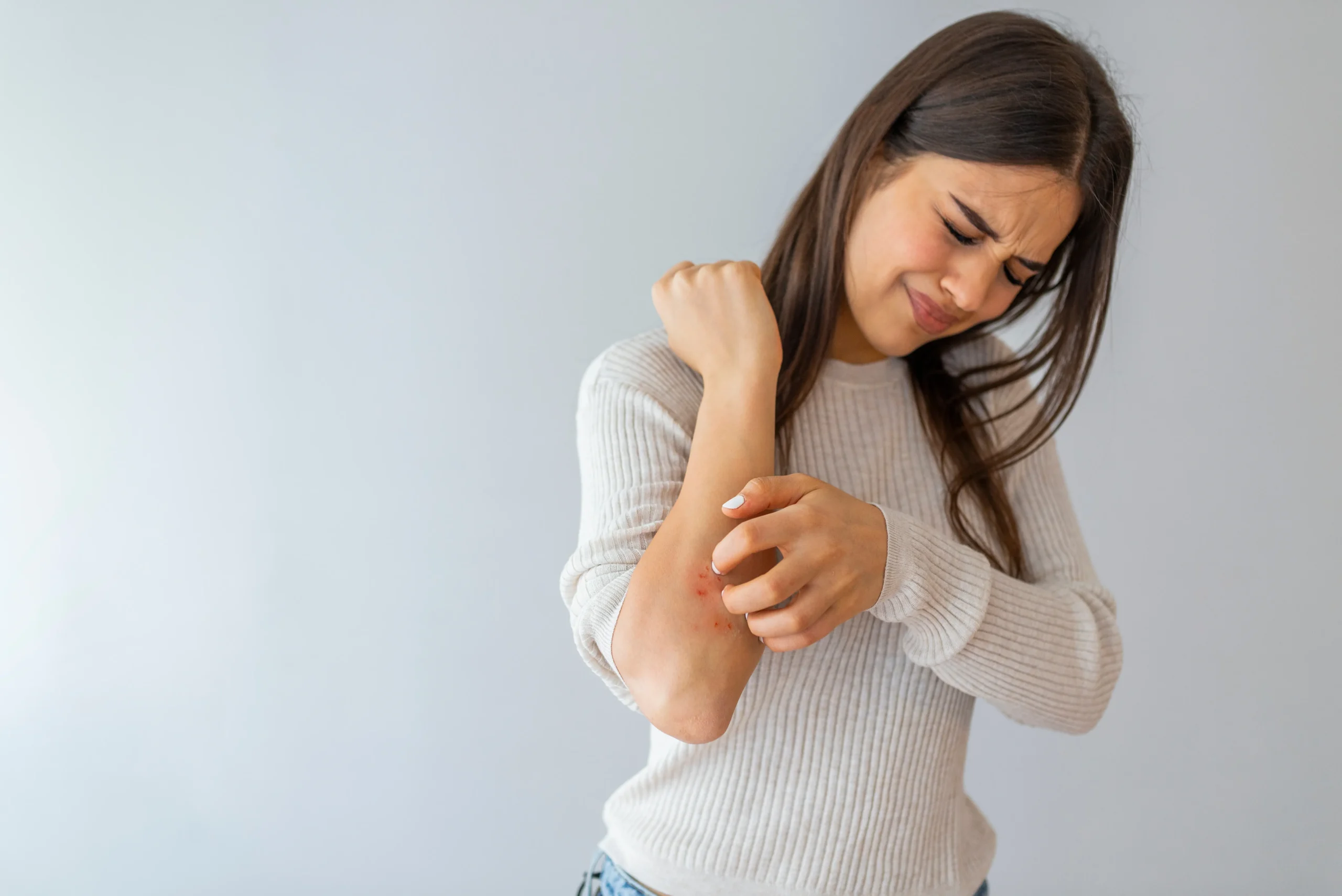 Women with allergy in the hands | nova vitacare | Texas